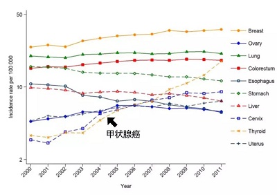 甲状腺癌专家谈脱发增加癌症风险